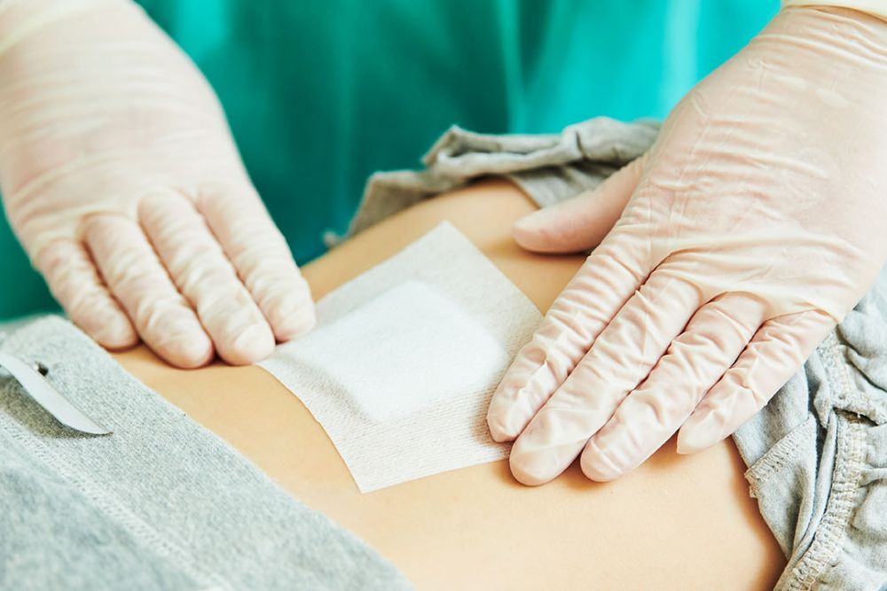 Gestire una medicazione post operatoria slide desc