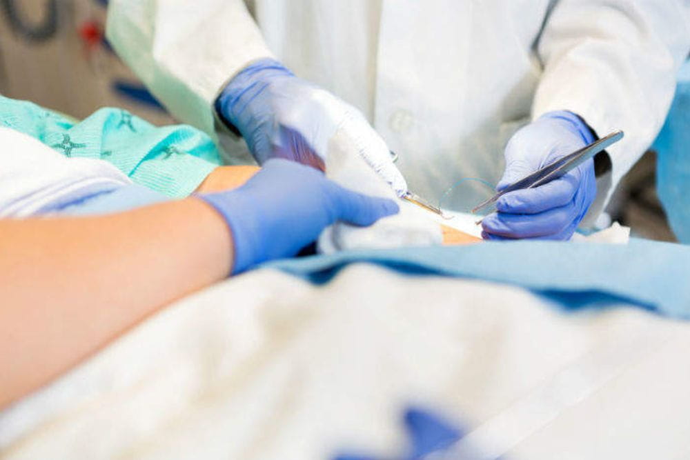 Sutura in ambulatorio