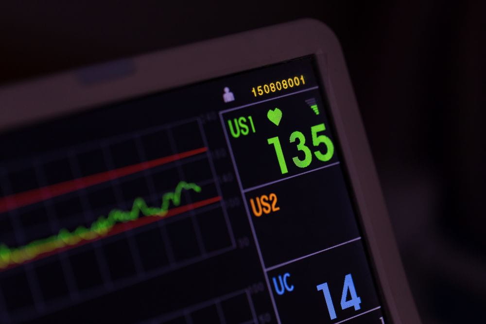 elettrocardiografo grafico