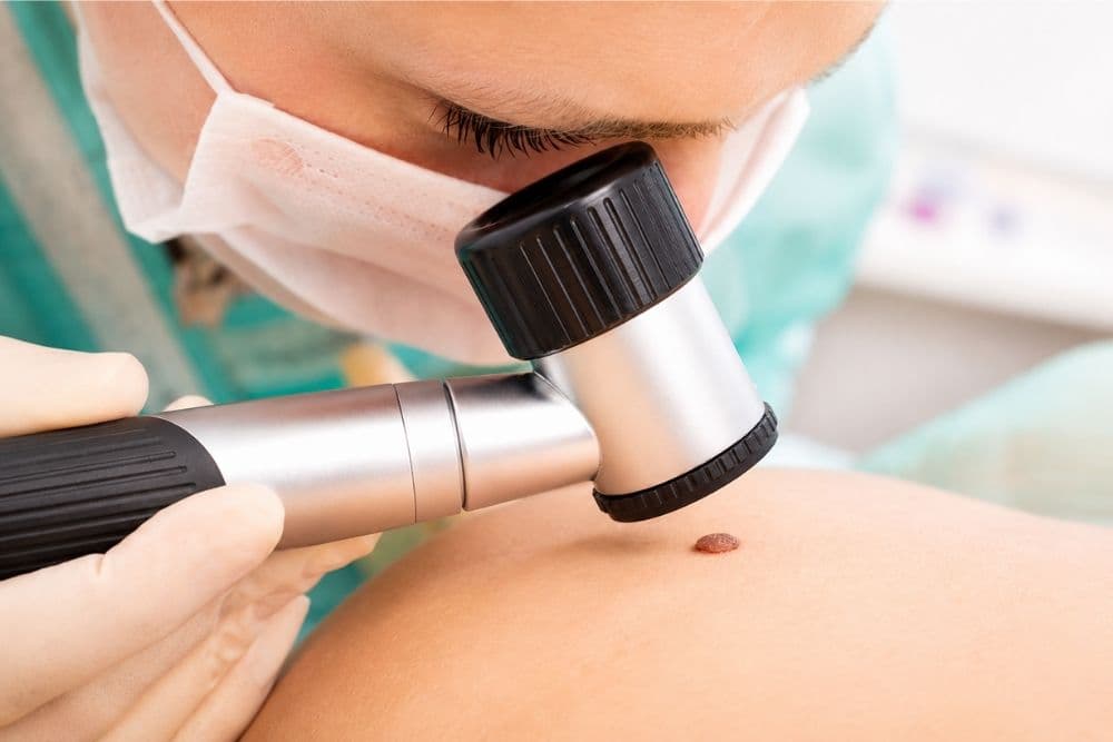 dermatoscopia-immagine-articolo-blog